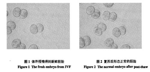 液氮運(yùn)輸罐短期儲(chǔ)存胚胎的可行性研究的結(jié)果